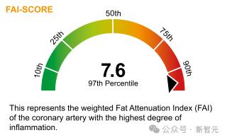 AI视觉算法登柳叶刀!看CT提前10年预测致命心脏疾病,已进入临床使用