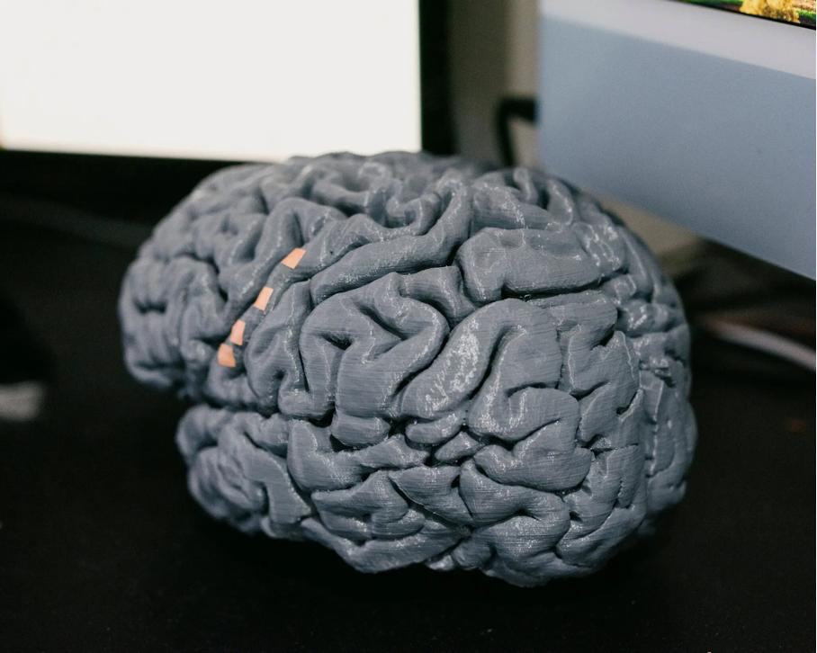 渐冻症偷走了他的语言能力,脑机接口+AI又帮他找了回来