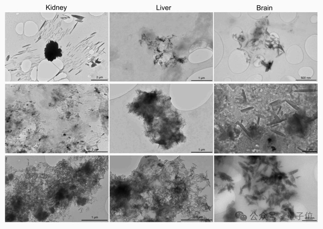 让Karpathy倍感意外的研究:人类大脑已被塑料污染