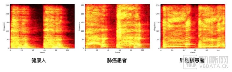 谷歌大模型下场,FDA完成首批,这个AI赛道起飞在即