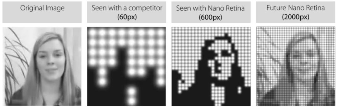 脑机接口和 AI，一个硬币的两面