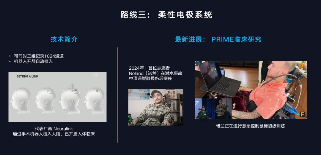 脑机接口和 AI，一个硬币的两面